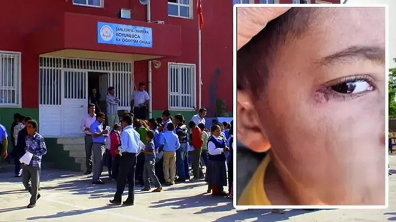 Öğrencinin yüzünde sigara söndürmüştü, tutuklandı!