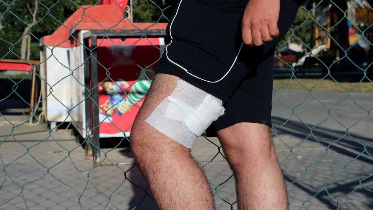 Parkta lise öğrencilerini dövüp, bıçaklayan 6 şüpheli yakalandı