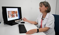Derideki ağrılı nodüller o hastalığın belirtisi olabilir!