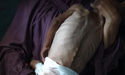 Gazze'de son 24 saatte 1'i çocuk 6 kişi açlıktan hayatını kaybetti