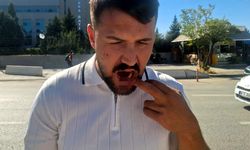 Ankara'da taksiciyi darbeden 4 şüpheli yeniden gözaltında!