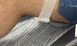 Liseli gençlerin kavgası kanlı bitti