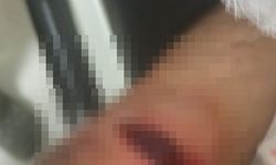 Mardin'de 2 aile arasında kavga çıktı