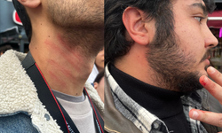 Polis gazeteciye saldırdı!