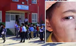 Öğrencinin yüzünde sigara söndürmüştü, tutuklandı!