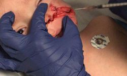 Ankara'da pitbull saldırısı!