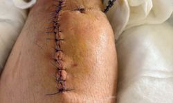 İzmir'de iş insanı evinin önünde silahlı saldırıya uğradı