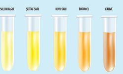 Berrak mı, Koyu mu? İdrar Rengi Sağlığın Şifresini Taşıyor!