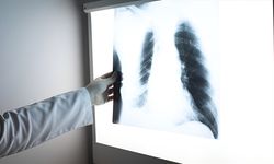 Enfeksiyonlar akciğer kapasitesini düşürüyor