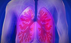 Akciğer Kanseri Tanısında Devrim