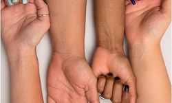 Alman kamu yayıncısından ironik 'ten rengi testi'