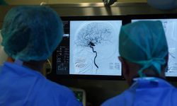 İnme tedavisinde yeni umut