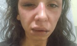Çekmeköy’de eşine şiddet uyguladığı iddia edilen şüpheli tutuklandı
