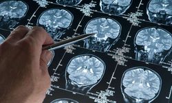 Derin uyku Alzheimer'ı yavaşlatıyor