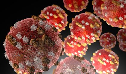 Endenozya'da kızamık salgını: 17 kişi yaşamını yitirdi