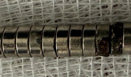 3 yaşındaki çocuk 19 mıknatıs yuttu