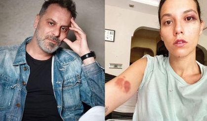 Ozan Güven’e 2 Yıl 3 Ay Hapis Cezası!