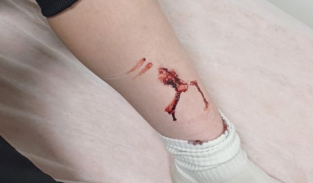 Çubuk'ta, başıboş köpekler 2 çocuğu ısırdı