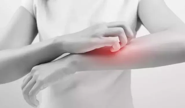 Arıya alerjisi olan hasta kurtarılamadı