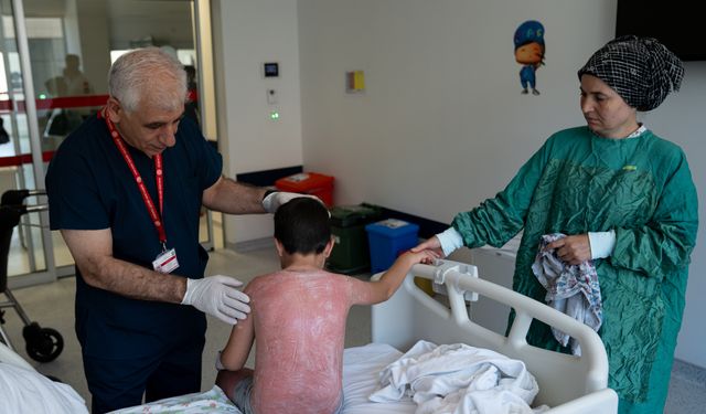 Güneşte 4 saat kaldı, vücudunda yanıklar oluştu!