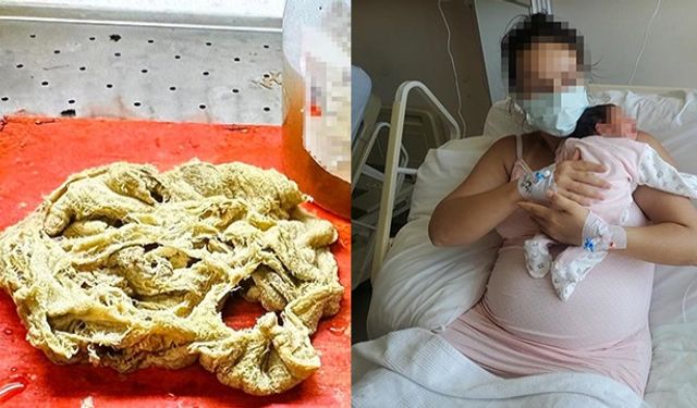 Doğumda unutlan gazlı bez 2 yıl sonra fark edildi!