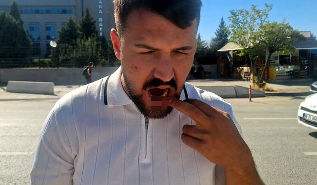 Ankara'da taksiciyi darbeden 4 şüpheli yeniden gözaltında!