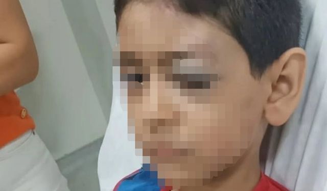 Çocuğa Müdahale Eden Polis Görevden Alındı