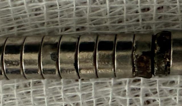 3 yaşındaki çocuk 19 mıknatıs yuttu