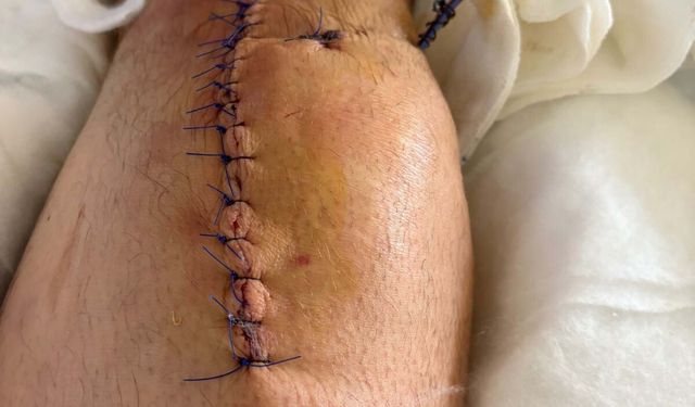 İzmir'de iş insanı evinin önünde silahlı saldırıya uğradı