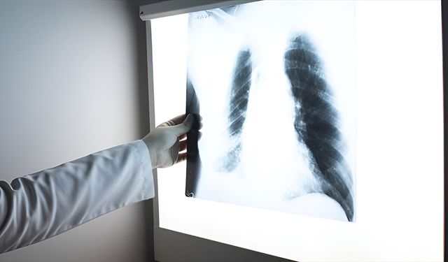 Enfeksiyonlar akciğer kapasitesini düşürüyor