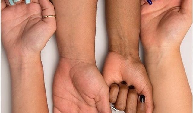 Alman kamu yayıncısından ironik 'ten rengi testi'