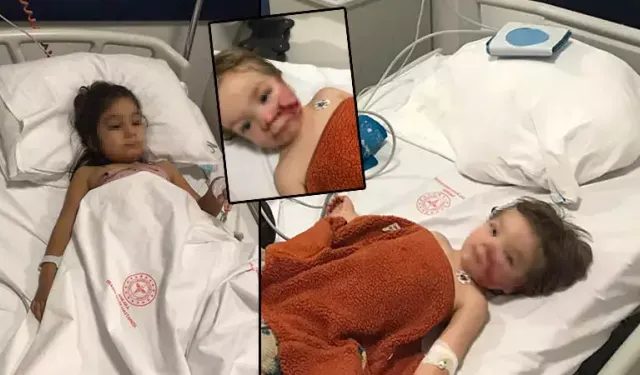 İki Kardeşe Saldıran Pitbull için 12 Kez Şikâyette Bulunulmuş