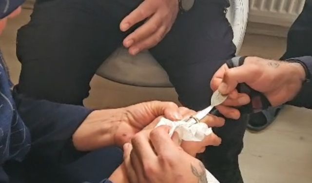 Parmağına yüzük sıkıştı