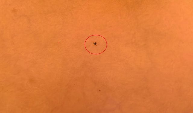 İnegöl’de Çocuğun Göğsüne Yapışan Kene Hastanede Çıkarıldı