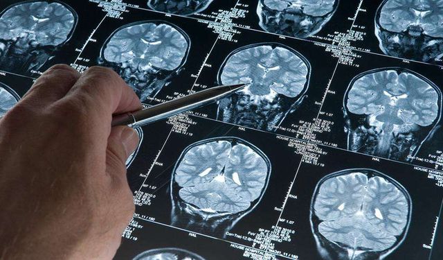 Derin uyku Alzheimer'ı yavaşlatıyor