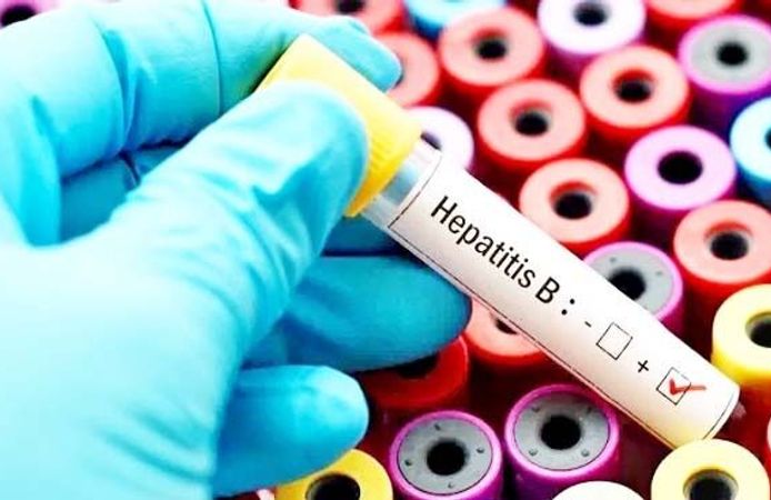 Uzmandan Hepatit B Uyarısı: HIV’den 100 Kat Daha Bulaşıcı