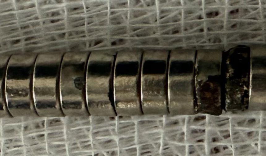 3 yaşındaki çocuk 19 mıknatıs yuttu