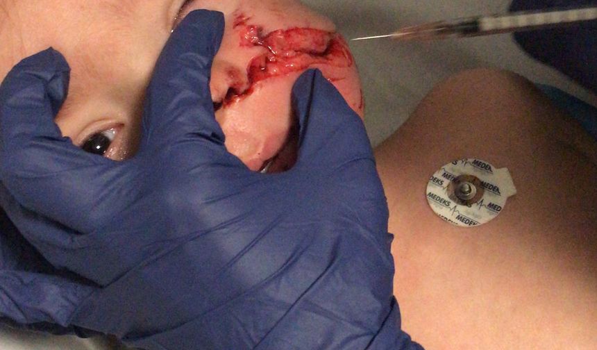 Ankara'da pitbull saldırısı!