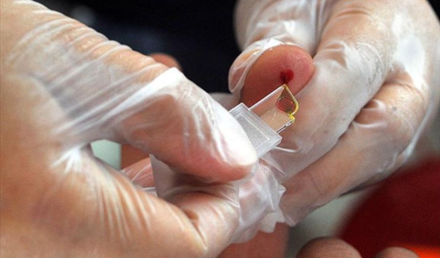 Rüyada Kan Görmek Ne Anlama Gelir?