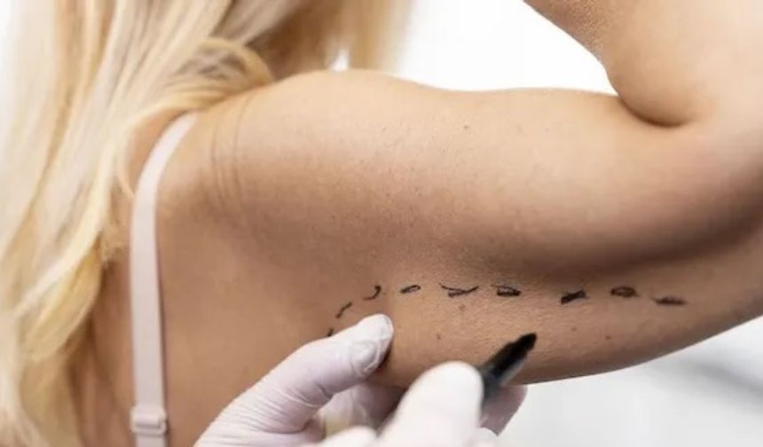 Kansere Karşı "Liposuction" Devrimi!