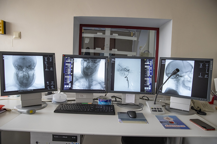 İnme Tedavisinde Yeni Umut3